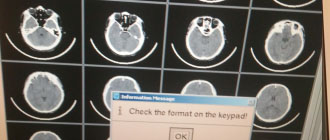 飞利浦BR-16slices CT HOST主机不能打印片子